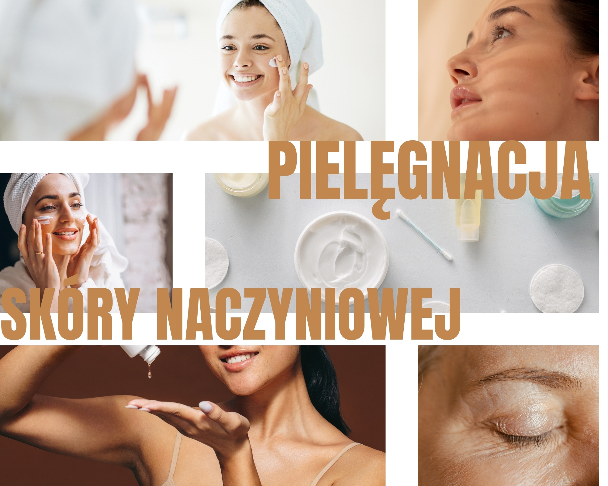 Pielęgnacja skóry naczynkowej - O czym musisz pamiętać? 