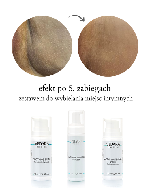 Aktywnie Wybielające Serum do Okolic Intymnych 100ml ( M180 ) Vedara Medical